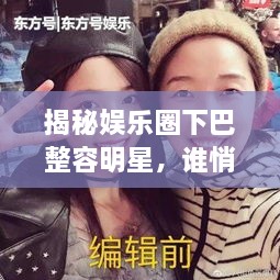 揭秘娛樂圈下巴整容明星，誰悄悄整過下巴？