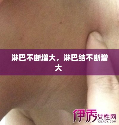 淋巴不斷增大，淋巴結(jié)不斷增大 