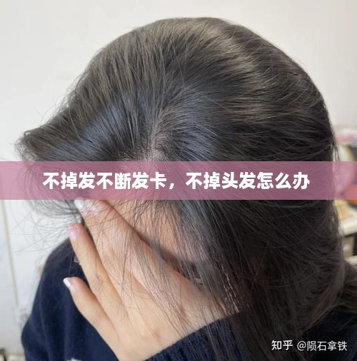 不掉發(fā)不斷發(fā)卡，不掉頭發(fā)怎么辦 