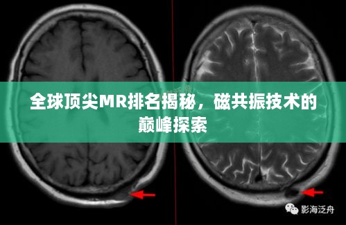 全球頂尖MR排名揭秘，磁共振技術(shù)的巔峰探索