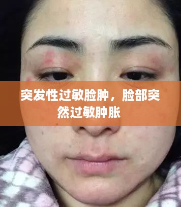 突發(fā)性過敏臉腫，臉部突然過敏腫脹 