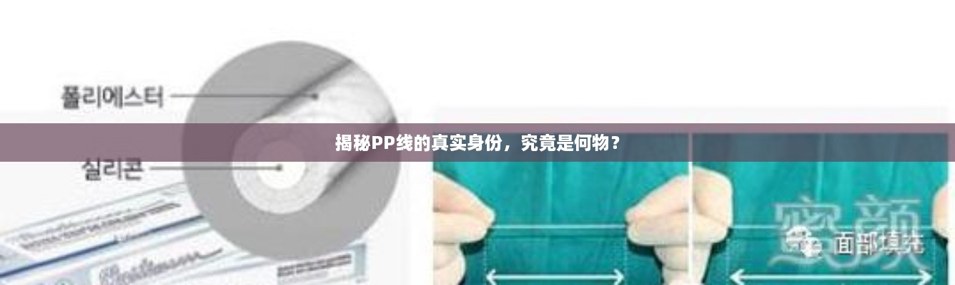 揭秘PP線的真實(shí)身份，究竟是何物？