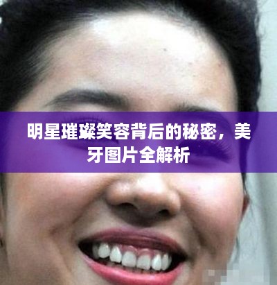 明星璀璨笑容背后的秘密，美牙圖片全解析