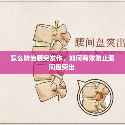 怎么防治腰突發(fā)作，如何有效防止腰間盤突出 