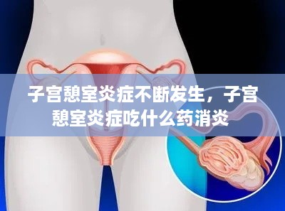 子宮憩室炎癥不斷發(fā)生，子宮憩室炎癥吃什么藥消炎 