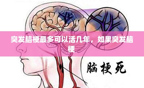 突發(fā)腦梗最多可以活幾年，如果突發(fā)腦梗 
