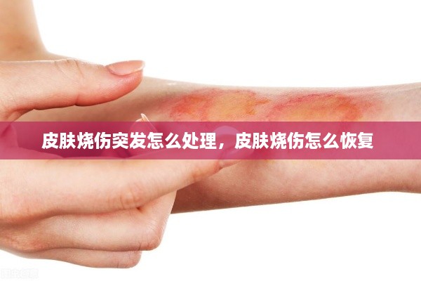 皮膚燒傷突發(fā)怎么處理，皮膚燒傷怎么恢復(fù) 
